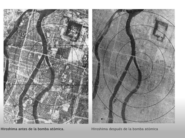 Bombas atomicas de hiroshima y nagasaki antes y despues de adelgazar